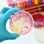 Microbiology