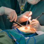 Surgery