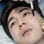 MCH Burn and Plastic Surgery